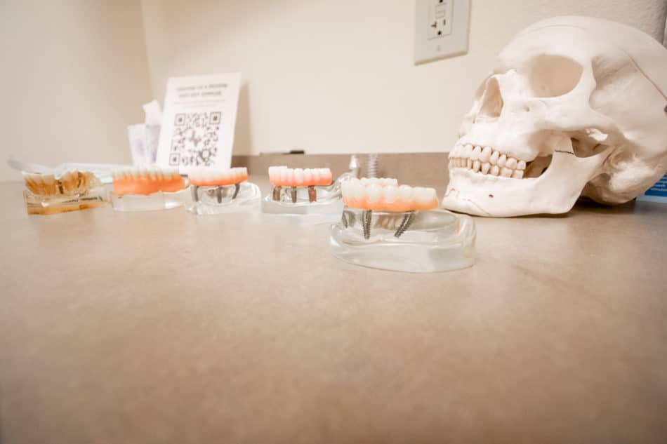 dental implants in Forney, TX